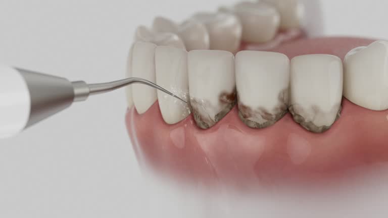 Reliable Dental contractor in Kean University, NJ by Dentist Open Now